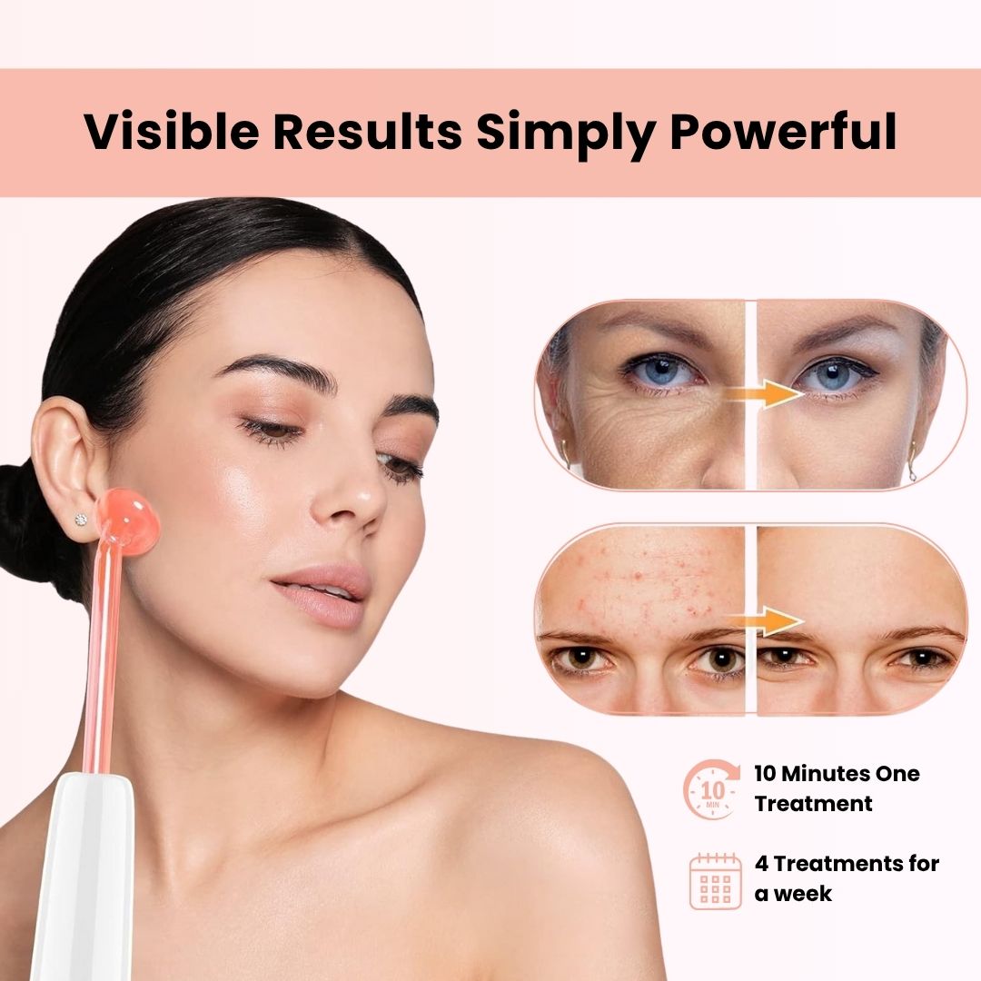 AcneOny™ – High Frequency Wand