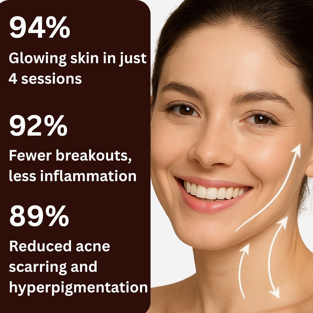 AcneOny™ – High Frequency Wand