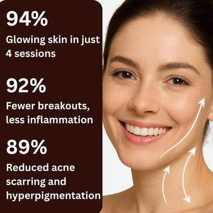 AcneOny™ – High Frequency Wand